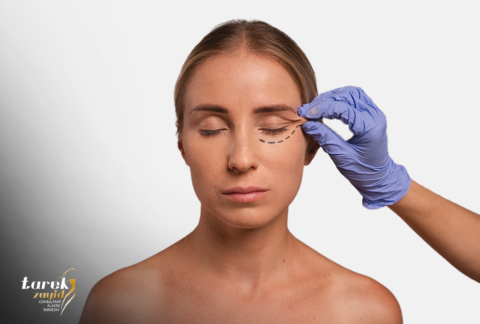 تجميل الجفون